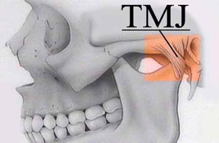 صداهای ناحیه فک و بیماری های ناشی از اختلال های مفصل